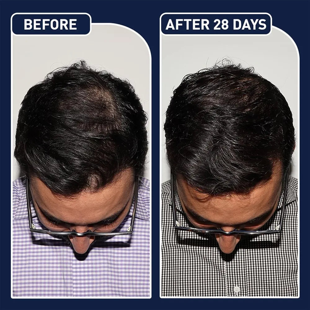 Feg Plus Hair Growth Spray