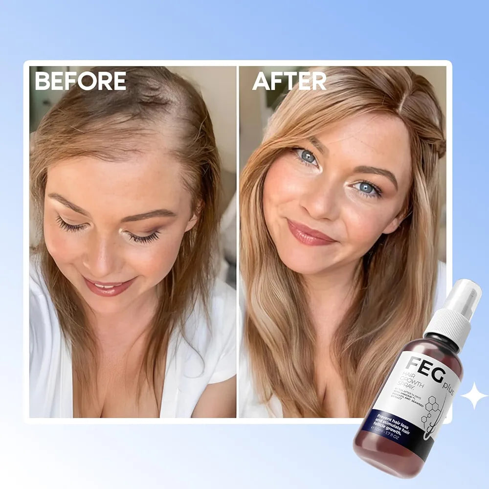 Feg Plus Hair Growth Spray