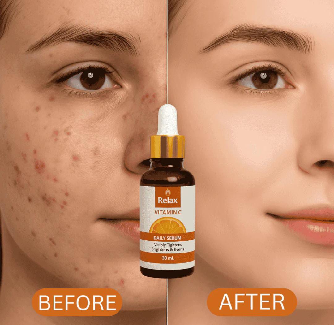 Relax Vitamin C Daily Serum – Glow & Radiance in Every Drop