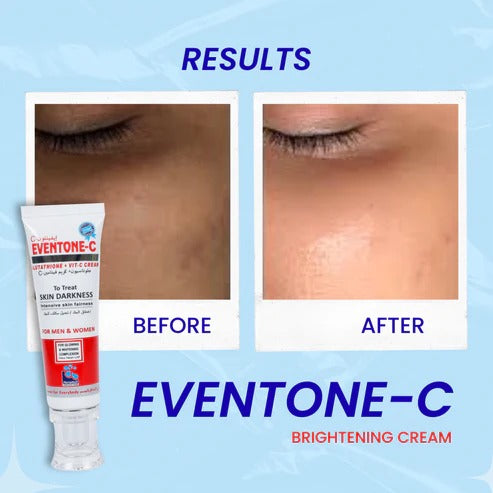 Eventone C Cream Buy 1 Get 1 Free