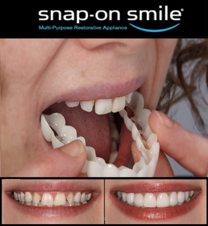 SNAP ON SMILE