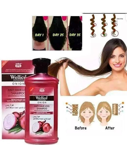 Wellice Onion Anti Hair Loss Shampoo